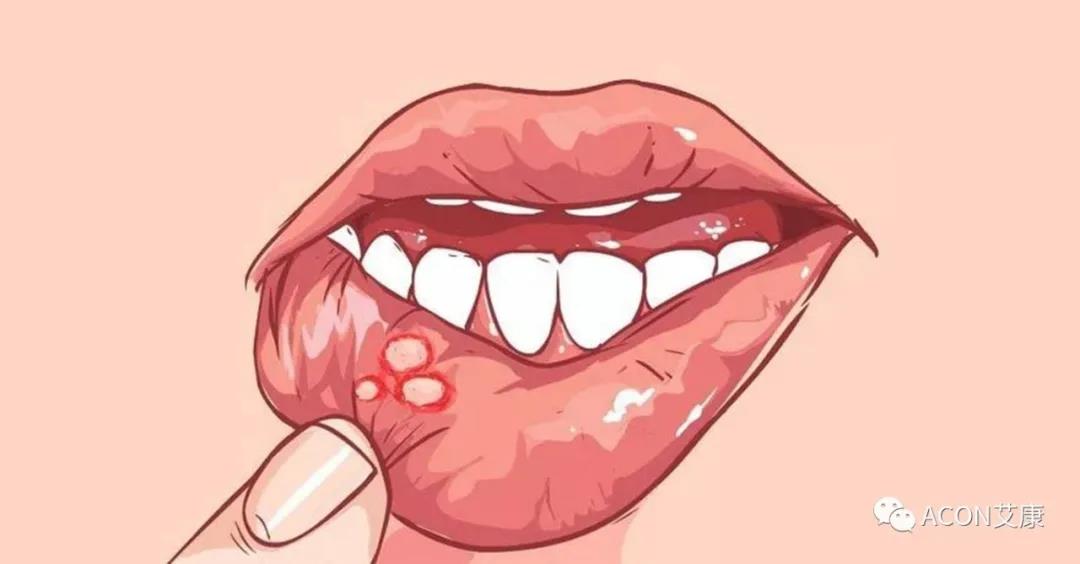 哪些小病容易讓人忽視，最后造成越拖越嚴(yán)重呢？
