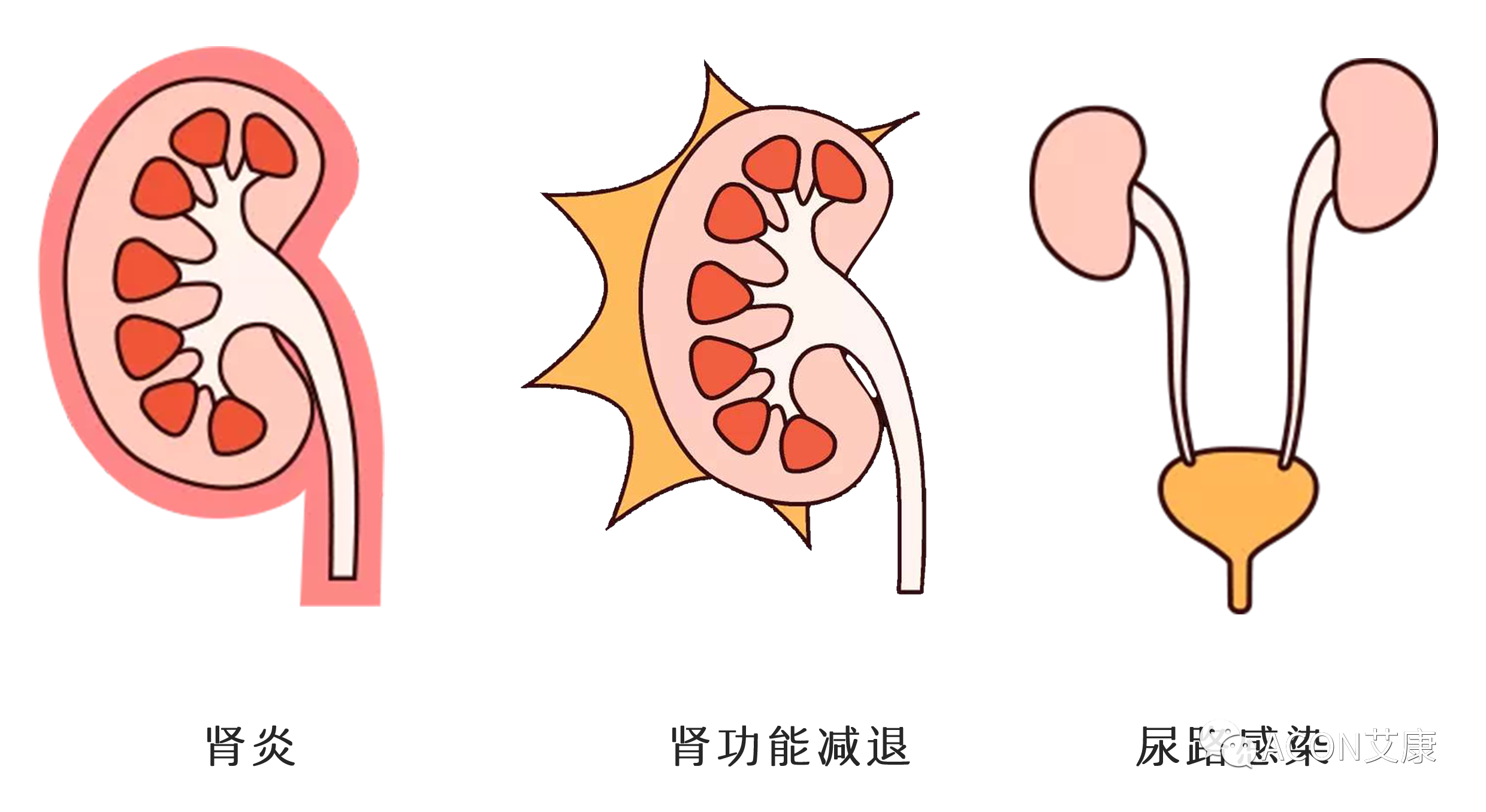 排尿黃、異味大，可能是身體在報警！