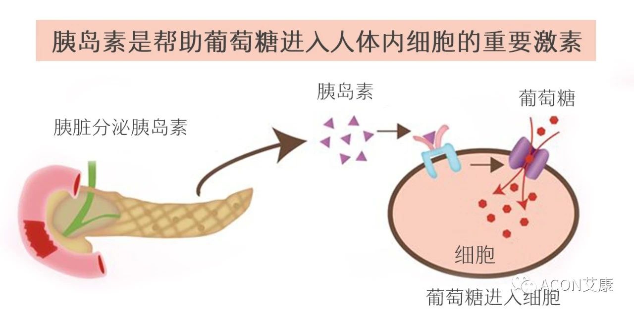 爆上熱搜，因爆發(fā)型糖尿病進入ICU，有哪些教訓值得我們汲取