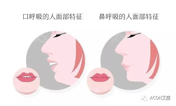 過敏性鼻炎會讓孩子變傻？！家長該如何應(yīng)對